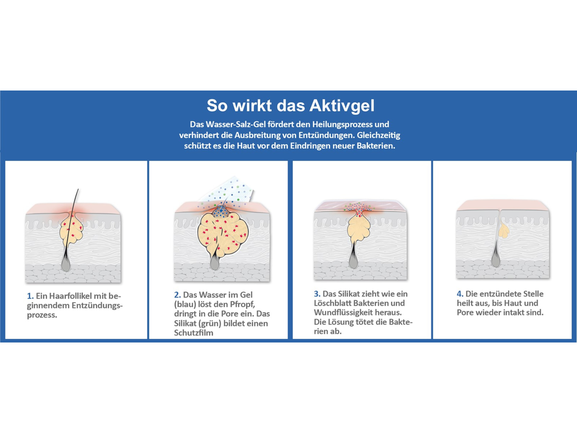 Prontomed Skin Balance akut gegen Pickel
